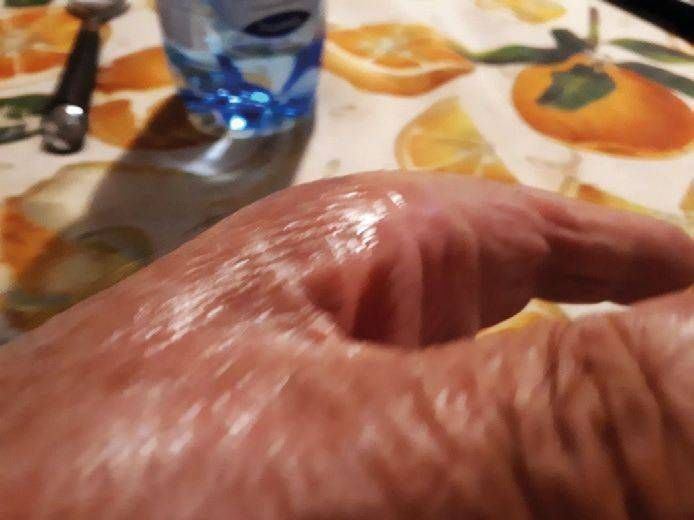 Cormano, morso da un ragno: finisce in ospedale Cormano morso ragno ospedale.