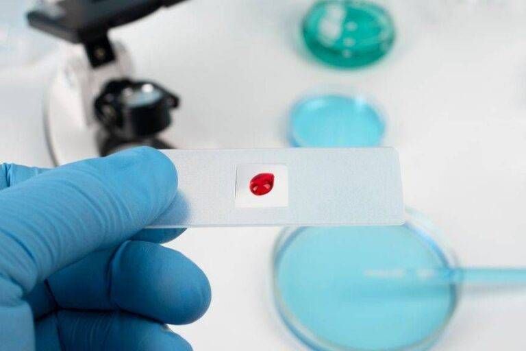Hiv e malattie sessualmente trasmissibili, screening gratuito a Muggiò nella giornata mondiale per la lotta all’Aids test hiv aids