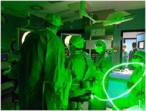 Green light laser desio