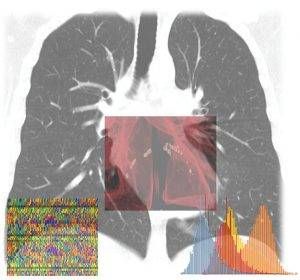intelligenza artificiale coronavirus