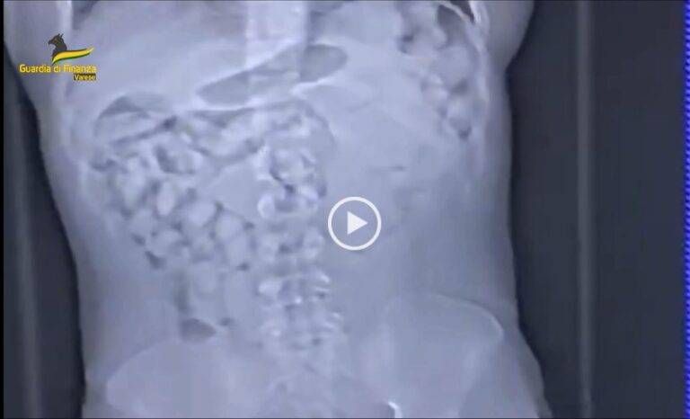 ovuli droga intestino malpensa