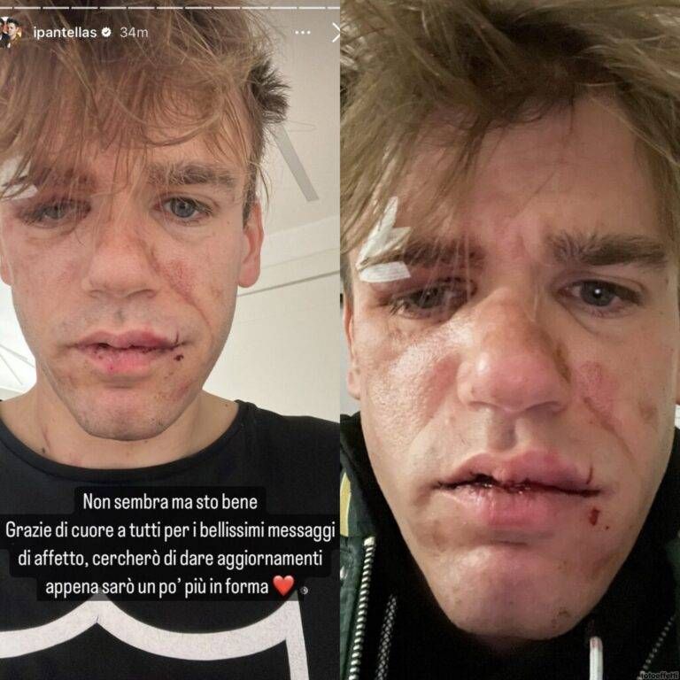 malnati rapina ipantellas