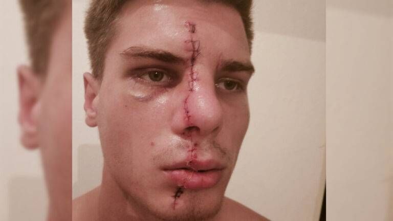 ragazzo sfregiato milano 768x432